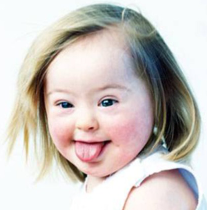 Beautiful Child with Down's Syndrome